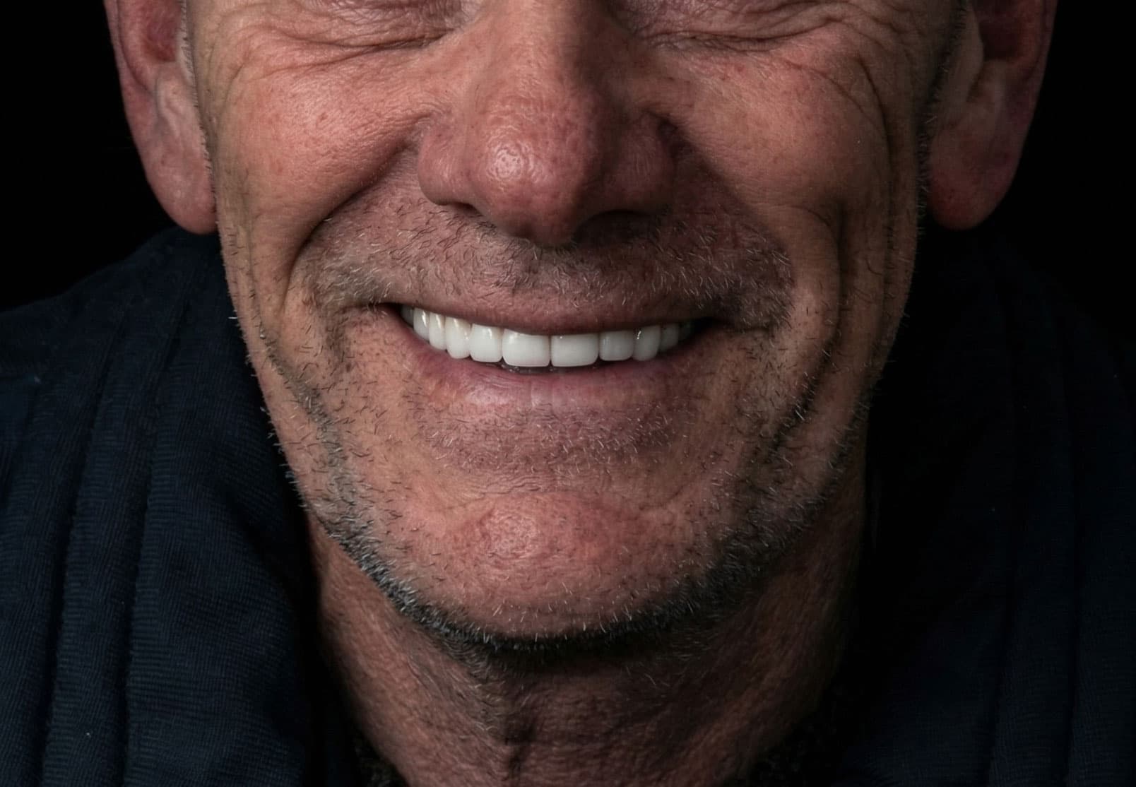 Patient smile after