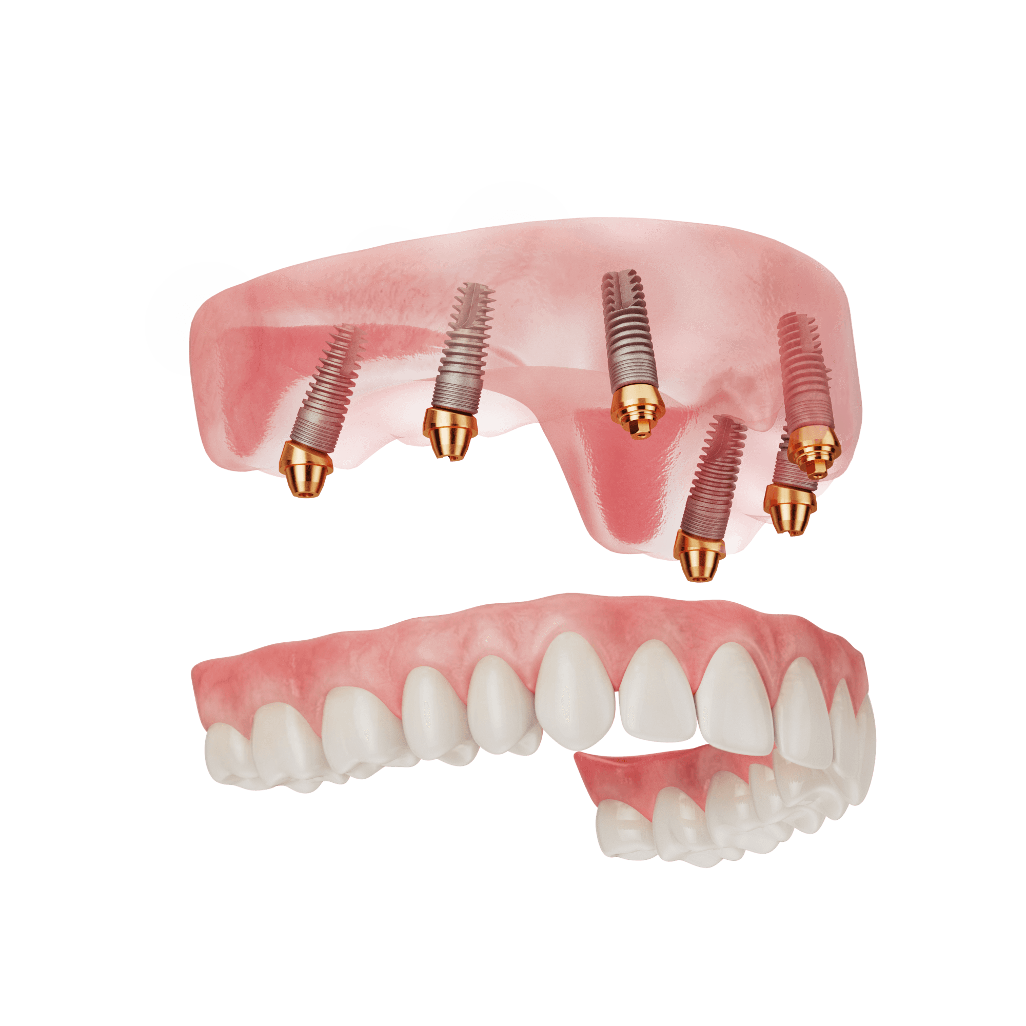 Dual Arch